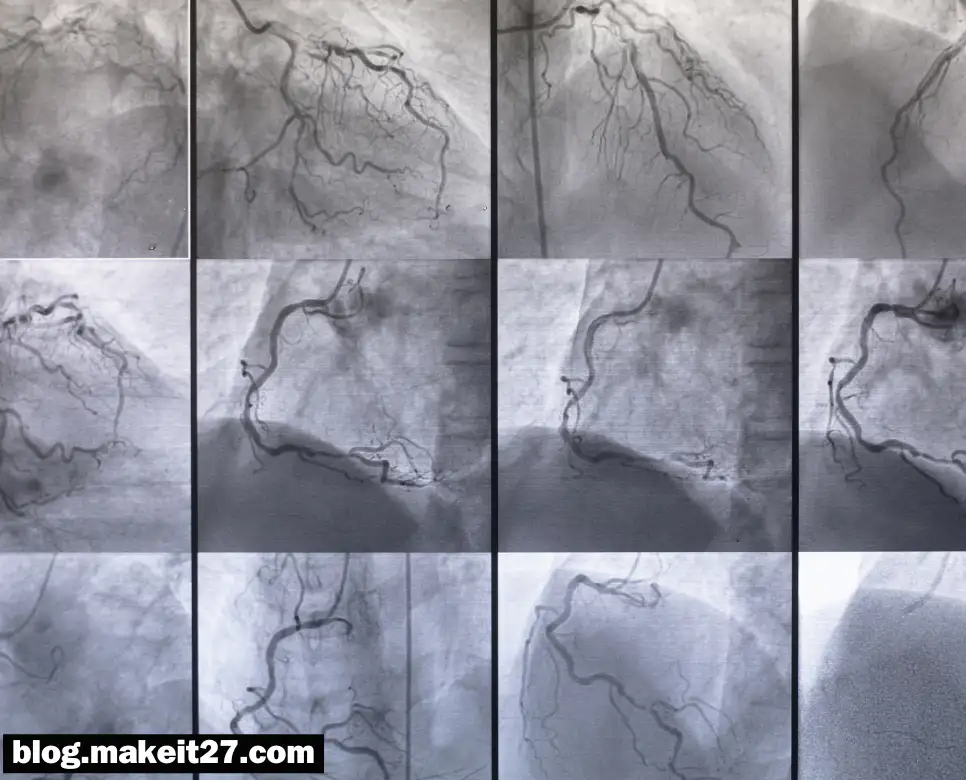 의학용어 CAG, PCD, QD