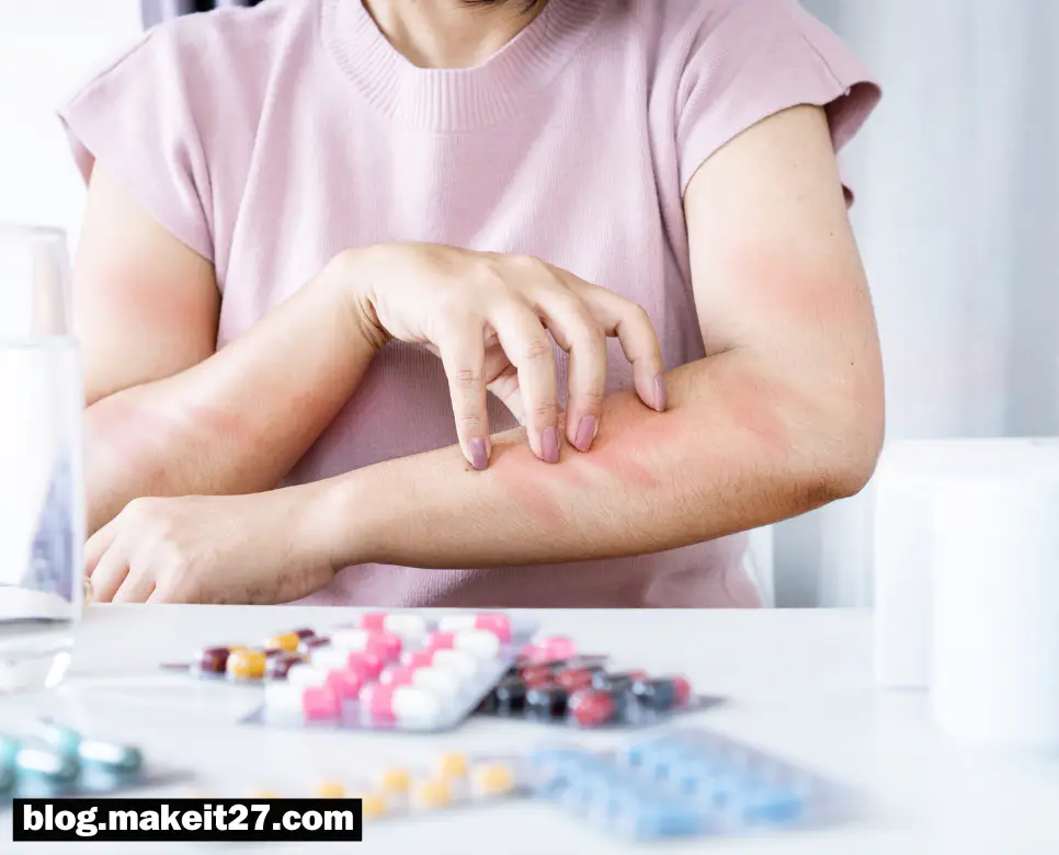 의학용어 ADR, AP, ASA