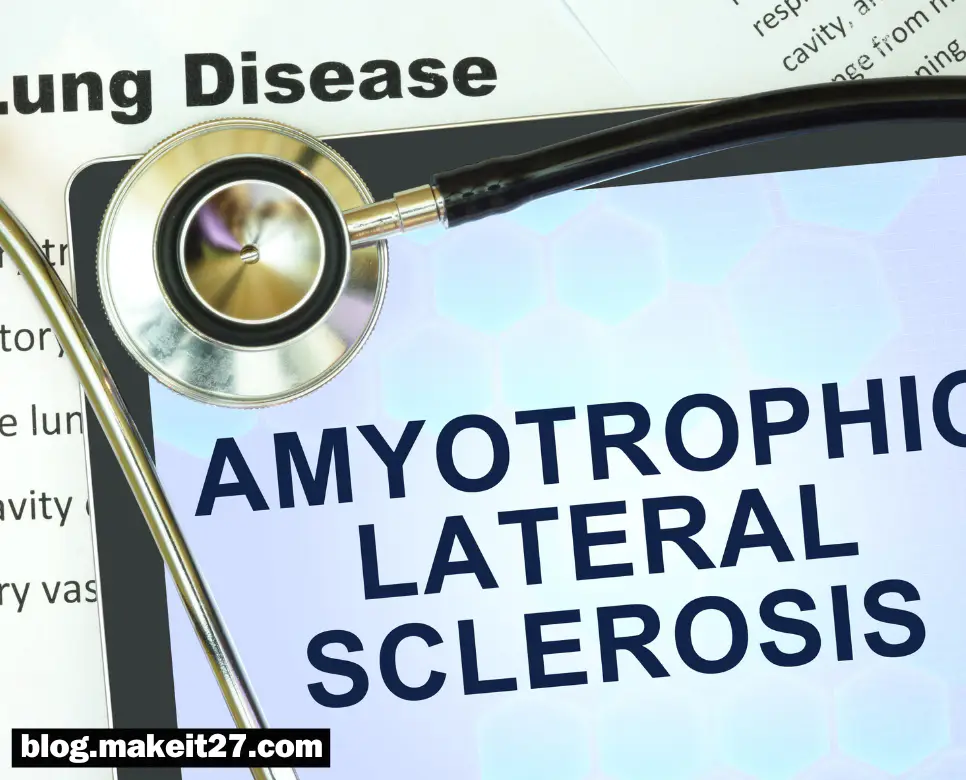 의학용어 ALS, ANA, ARDS