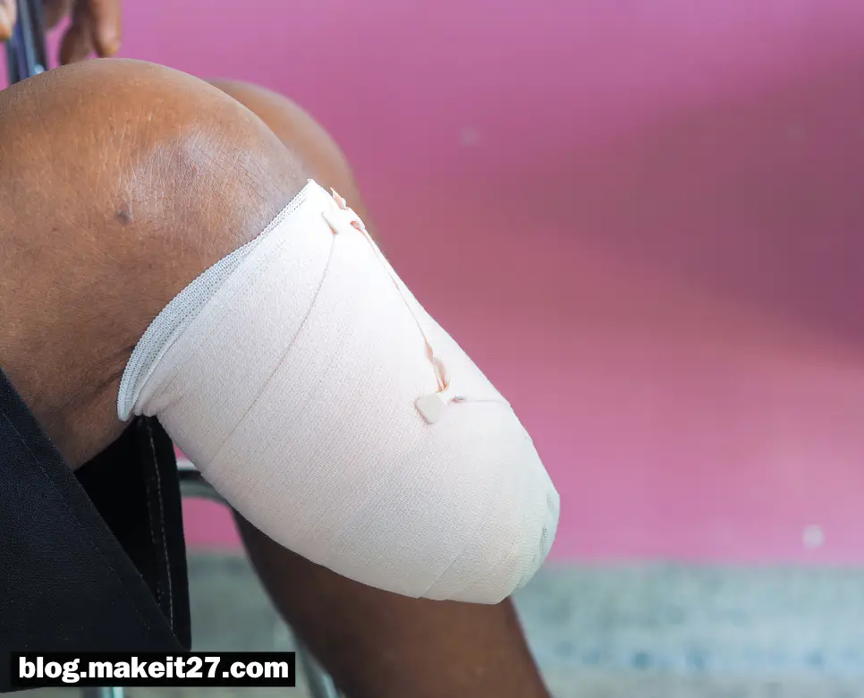 의학용어 BKA, BM, CA