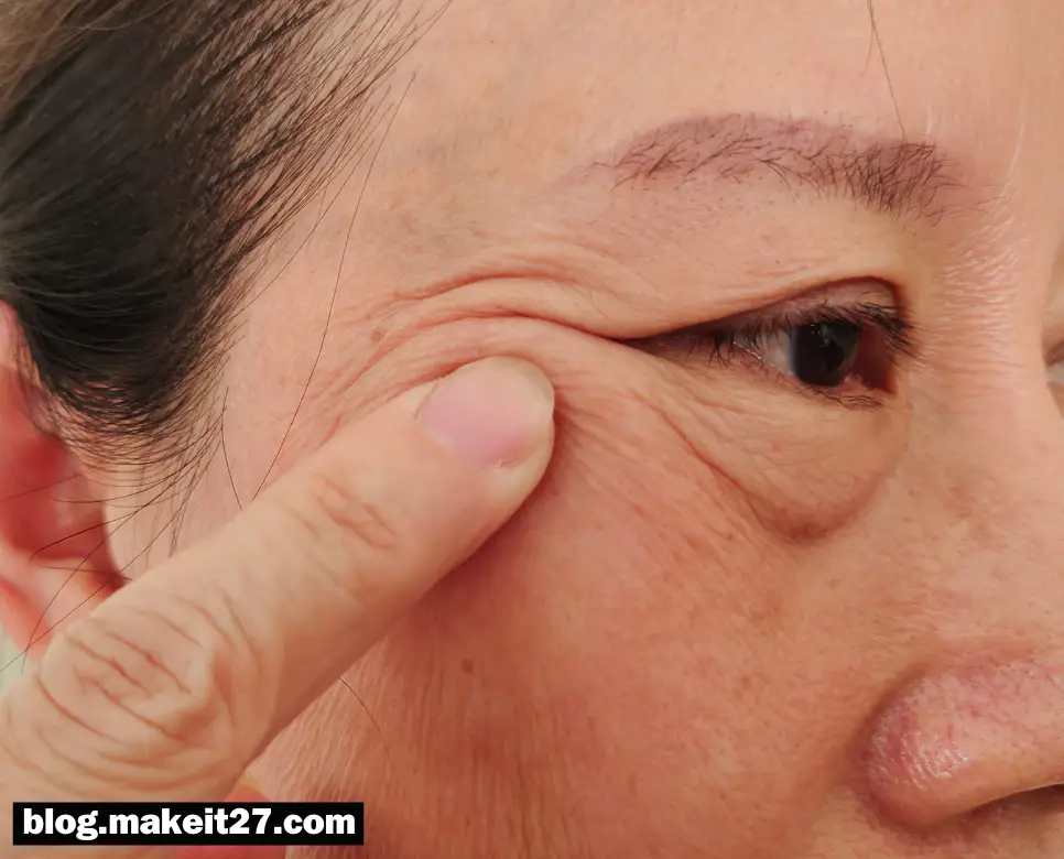 안검하수 뜻, 이명 뜻, 고지혈증 뜻: 정리해 드릴게요!