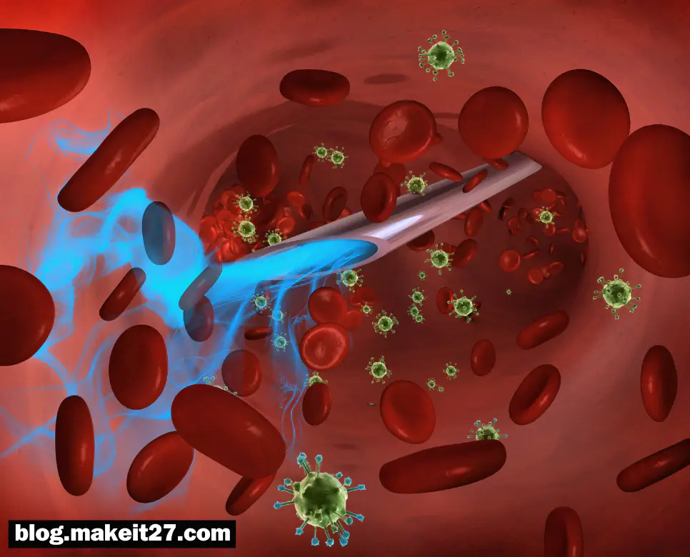 패혈증 뜻, 빈혈 뜻, 폐렴 뜻: 한눈에 해결!