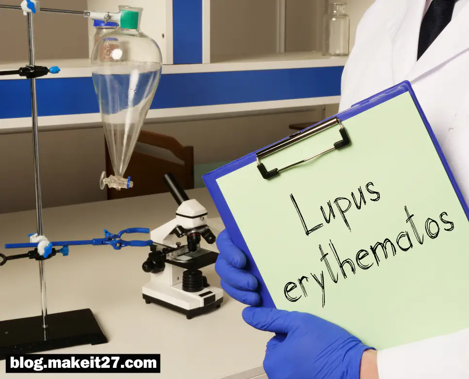 의학용어 SLE, SLR, SOAP